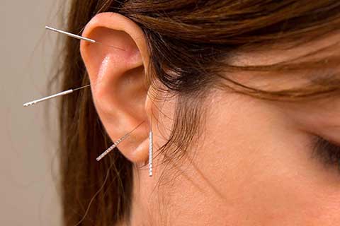 Acupunctuur in het oor 